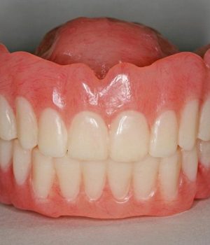 23A Provisional dentures