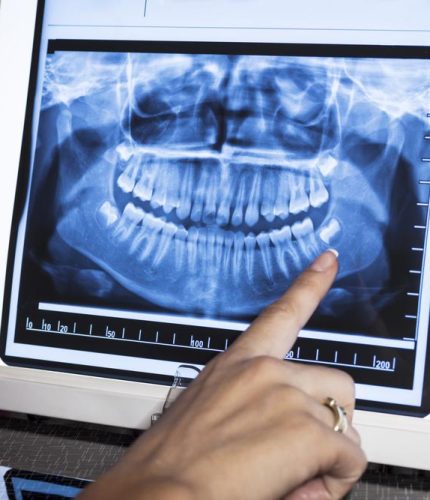 Digital-XRay-Dental