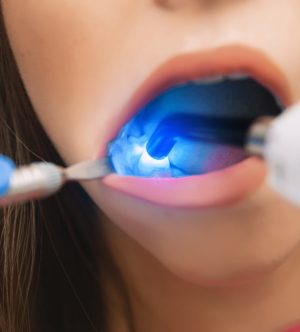 Laser-therapy-in-dentistry