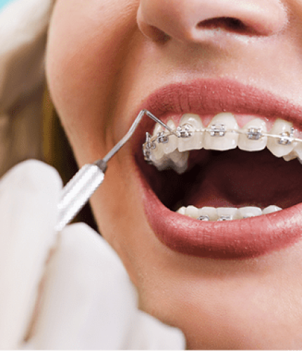 What-is-Orthodontic-Treatment-min