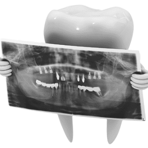 png-transparent-dental-x-ray-film-oral-examination-tooth-bacterial-thumbnail-removebg-preview (1)